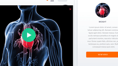 Advancing The Management Of Cardiovascular Disease